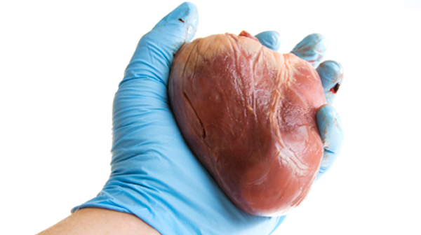 La mortalidad por insuficiencia cardiaca presenta diferencias de hasta el doble entre CCAA