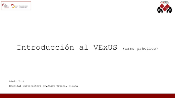 Introducción al VExUS (caso práctico)