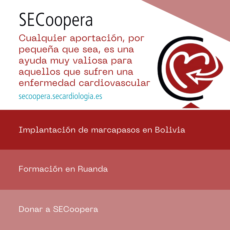 Proyecto SECoopera